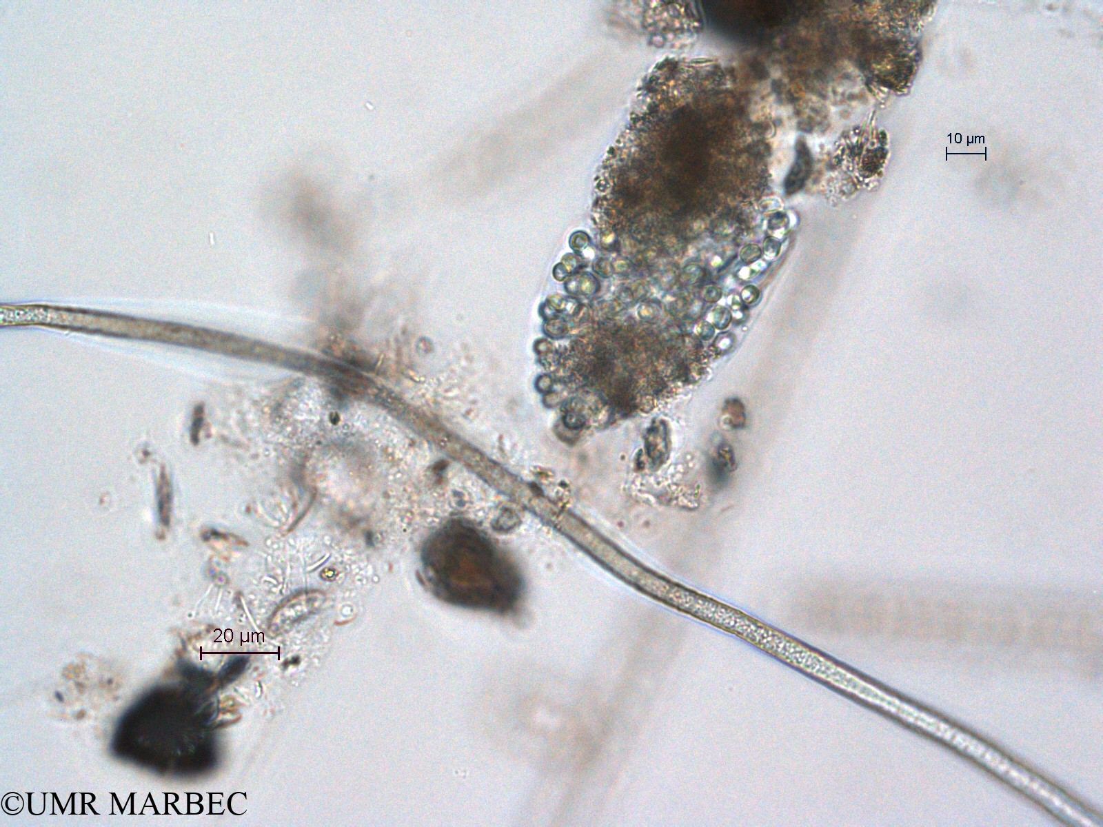 phyto/Scattered_Islands/all/COMMA April 2011/Aphanocapsa sp13 (old Chroococcus sp11 -dans pelotte fécale)(copy).jpg